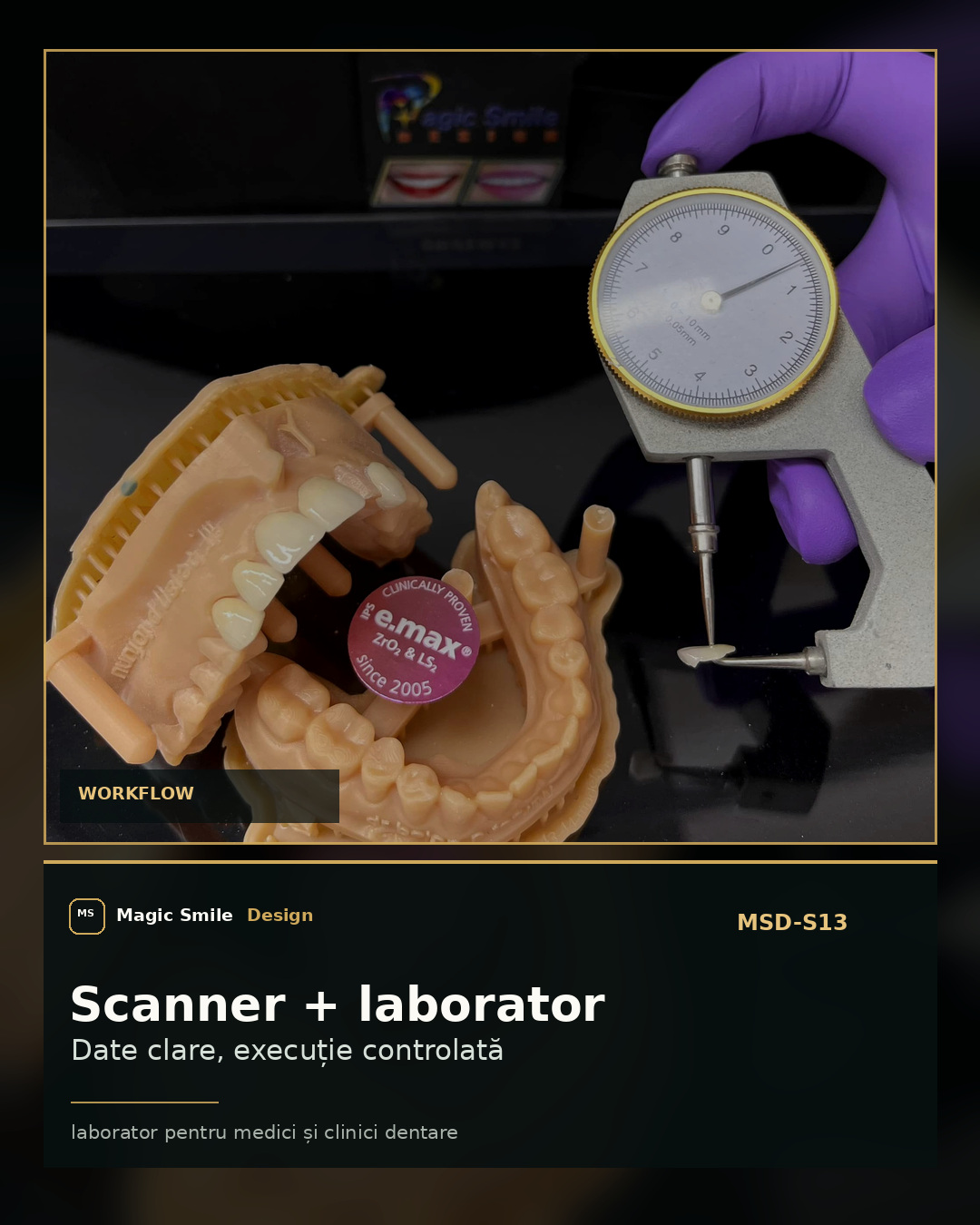 Instagram-ready Magic Smile Design laboratory scanner and model visual for dentist-facing case communication