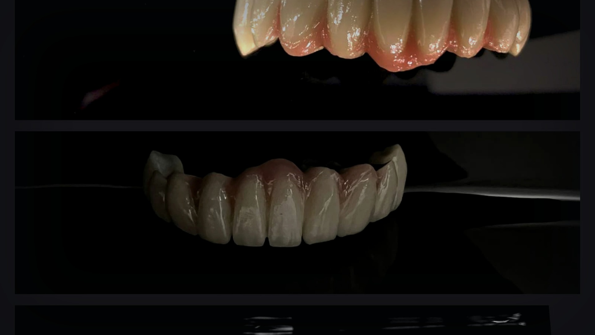 Metal-ceramic dental prosthetic work with ceramic support, depth and laboratory finishing context